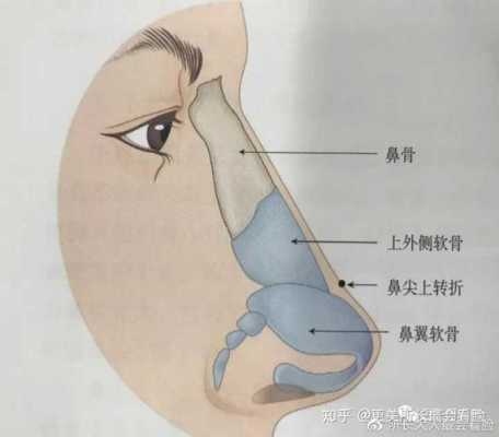 鼻梁骨短怎么办,胎儿鼻骨偏短会导致什么  第1张