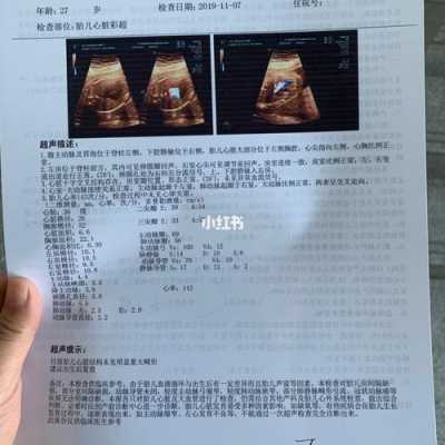 胎儿心脏彩超价格(做胎儿心脏彩超要多长时间) 第2张 胎儿心脏彩超价格(做胎儿心脏彩超要多长时间) 第2张
