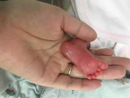 孕28周胎儿体重(怀孕28周胎儿体重2斤多一点,宝宝会不会很瘦) 第2张 孕28周胎儿体重(怀孕28周胎儿体重2斤多一点,宝宝会不会很瘦) 第2张