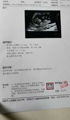 胎儿鼻骨发育不良(怀孕产检,nt检查结果看不到鼻骨咋办,胎儿会不会有问题呢) 第1张 胎儿鼻骨发育不良(怀孕产检,nt检查结果看不到鼻骨咋办,胎儿会不会有问题呢) 第1张