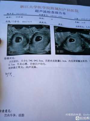 多久胎儿有胎心(多久胎儿有胎心胎芽) 第1张 多久胎儿有胎心(多久胎儿有胎心胎芽) 第1张