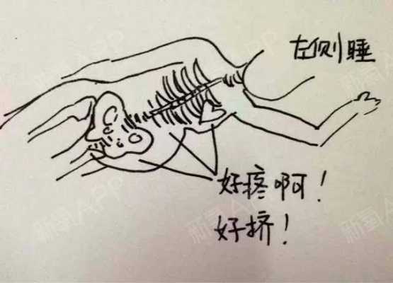 孕期肋骨(孕期肋骨疼怎么回事) 第2张 孕期肋骨(孕期肋骨疼怎么回事) 第2张