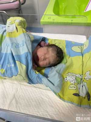 34周胎儿在肚子里是什么样子的呢,胎儿在腹腔里能不能存活  第2张
