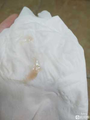 孕妇见红的常见原因有哪些,孕期见红是什么原因导致的 第3张 孕妇见红的常见原因有哪些,孕期见红是什么原因导致的 第3张