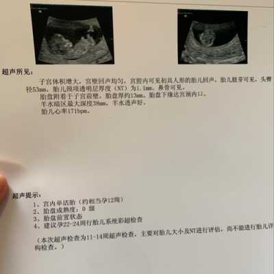 胎儿偏小十天(胎儿偏小十天怎么办,要紧吗) 第2张 胎儿偏小十天(胎儿偏小十天怎么办,要紧吗) 第2张