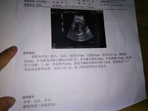 医生说胎儿腿长(医生说胎儿腿长是暗示男女吗) 第3张 医生说胎儿腿长(医生说胎儿腿长是暗示男女吗) 第3张