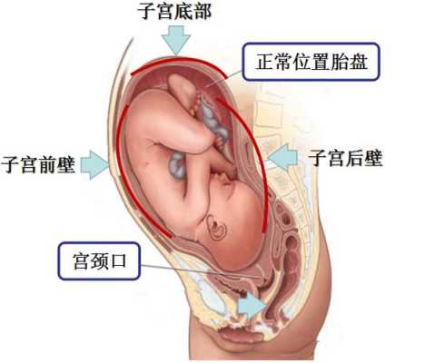 什么是胎盘向后,胎儿与胎盘的位置图片  第2张