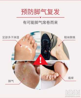 孕期有脚气怎么办(孕期有脚气怎么办用什么可以止痒) 第2张 孕期有脚气怎么办(孕期有脚气怎么办用什么可以止痒) 第2张