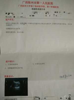 胎儿积液(朋友怀孕去产检,查出胎儿肾积水,正常值是多少啊) 第2张 胎儿积液(朋友怀孕去产检,查出胎儿肾积水,正常值是多少啊) 第2张