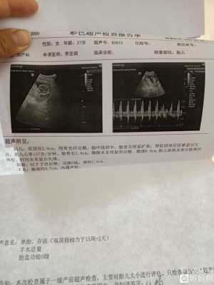 胎儿心率159（胎儿心率159是男孩女孩）  第2张