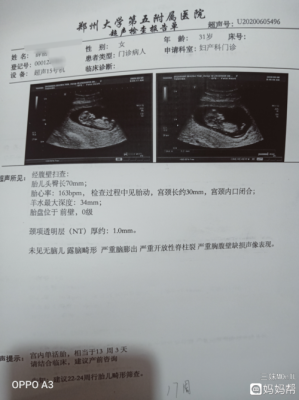 从2020年12月15号至2021年的12月15号一共多少周,胎儿15周有多大图片 第2张 从2020年12月15号至2021年的12月15号一共多少周,胎儿15周有多大图片 第2张