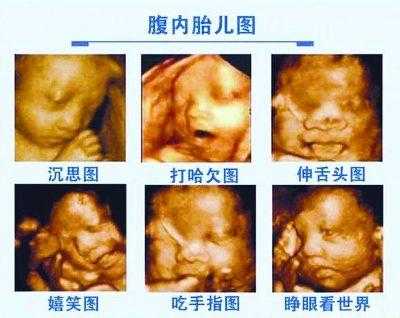 孕期什么时候做四维(孕期什么时候做四维彩超最好) 第2张 孕期什么时候做四维(孕期什么时候做四维彩超最好) 第2张
