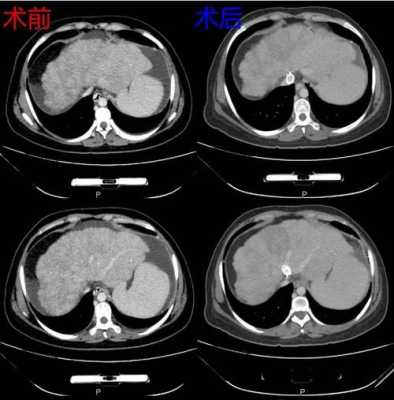 孕期ct(孕期ct对胎儿的影响) 第2张 孕期ct(孕期ct对胎儿的影响) 第2张