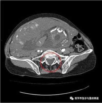 孕期ct(孕期ct对胎儿的影响) 第3张 孕期ct(孕期ct对胎儿的影响) 第3张