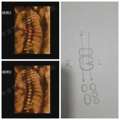 胎儿的脊柱(胎儿的脊柱一般都不会有问题吧) 第2张 胎儿的脊柱(胎儿的脊柱一般都不会有问题吧) 第2张