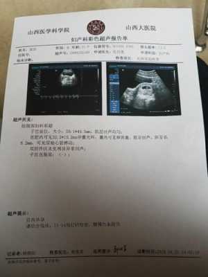 7周胎儿大小(怀孕7周胚芽大小标准值是多少的) 第3张 7周胎儿大小(怀孕7周胚芽大小标准值是多少的) 第3张