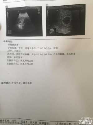 胎儿没有胎心怎么办(胎儿没有胎心怎么办6周了) 第2张 胎儿没有胎心怎么办(胎儿没有胎心怎么办6周了) 第2张