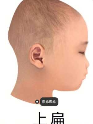 胎儿头围小怎么办（两个月宝宝头蹭来蹭去的是怎么回事啊）  第2张
