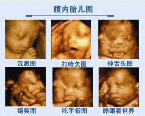 孕期做四维(孕期做四维的最佳时间) 第1张 孕期做四维(孕期做四维的最佳时间) 第1张
