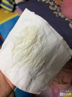 怀孕期间白带异常(怀孕期间白带不正常) 第3张 怀孕期间白带异常(怀孕期间白带不正常) 第3张
