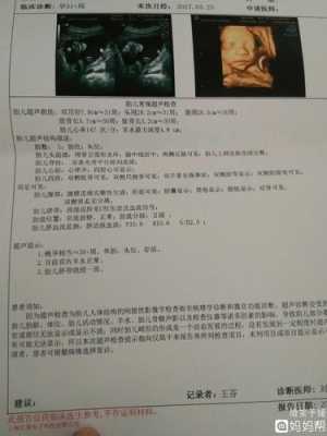 胎儿偏小一周是什么原因引起的,为什么胎儿会偏小一周  第1张
