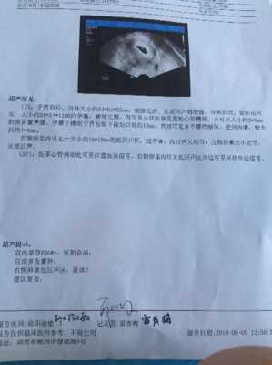 怀孕初期做阴超对胎儿有影响吗,阴超对胎儿有影响吗 怀孕早期 第2张 怀孕初期做阴超对胎儿有影响吗,阴超对胎儿有影响吗 怀孕早期 第2张