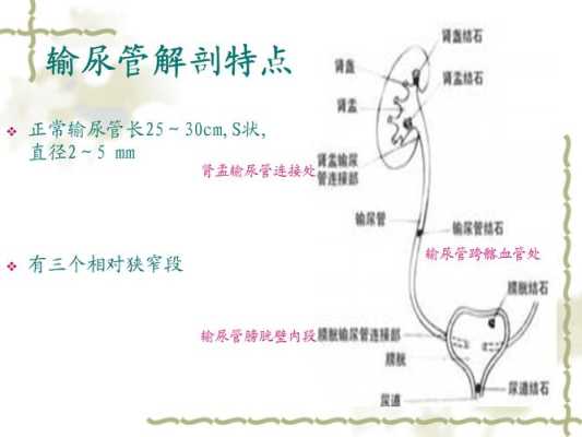 胎儿输尿管狭窄(输尿管狭窄手术费用是多少) 第1张 胎儿输尿管狭窄(输尿管狭窄手术费用是多少) 第1张