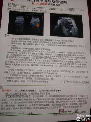胎儿三尖瓣少量反流(胎儿三尖瓣少量反流什么原因造成的) 第2张 胎儿三尖瓣少量反流(胎儿三尖瓣少量反流什么原因造成的) 第2张