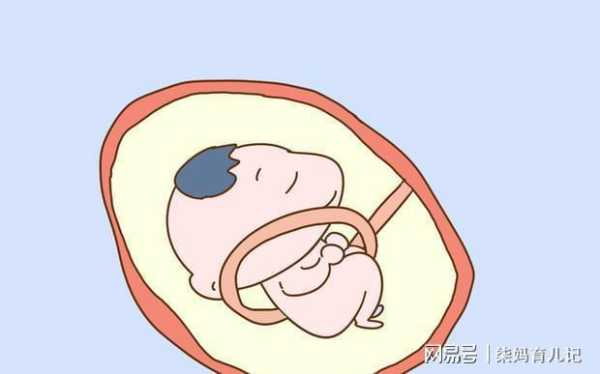 胎儿颈后见u型压迹是什么意思,胎儿u型压迹是什么意思 第3张 胎儿颈后见u型压迹是什么意思,胎儿u型压迹是什么意思 第3张