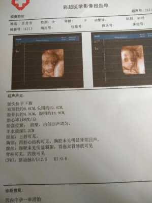 两周的胎儿(两周的宝宝视力有多远) 第1张 两周的胎儿(两周的宝宝视力有多远) 第1张