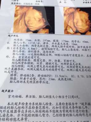 四维彩超官宣文案,四维彩超胎儿照片分得出男女吗?  第2张