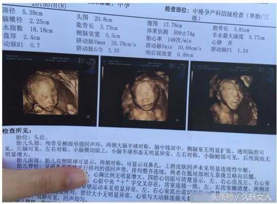 四维彩超官宣文案,四维彩超胎儿照片分得出男女吗?  第3张