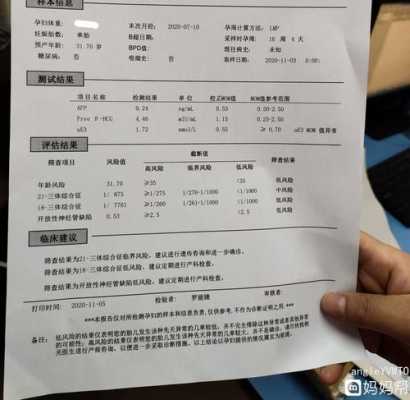 唐筛胎儿(唐筛胎儿偏大一周影响结果吗) 第2张 唐筛胎儿(唐筛胎儿偏大一周影响结果吗) 第2张