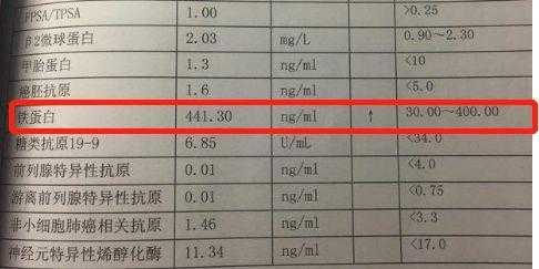 孕期铁蛋白高是什么原因,铁蛋白孕期正常值是多少 第1张 孕期铁蛋白高是什么原因,铁蛋白孕期正常值是多少 第1张