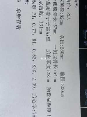 胎儿腿短怎么补(孩子腿短身子长怎么办) 第1张 胎儿腿短怎么补(孩子腿短身子长怎么办) 第1张