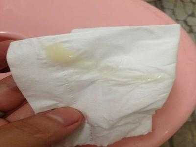怀孕期间有白带吗(怀孕会有分泌物吗) 第3张 怀孕期间有白带吗(怀孕会有分泌物吗) 第3张