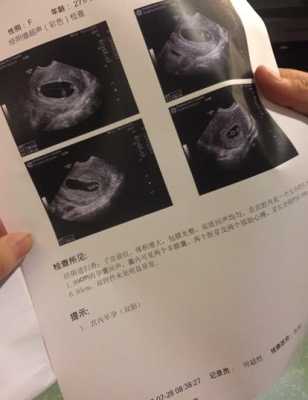 胎儿6周(胎儿6周有胎心了吗) 第1张 胎儿6周(胎儿6周有胎心了吗) 第1张
