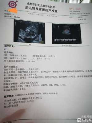 胎儿nt检查是什么(nt检查是什么?孕期做nt检查是检查什么项目呢) 第3张 胎儿nt检查是什么(nt检查是什么?孕期做nt检查是检查什么项目呢) 第3张