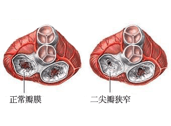 胎儿心脏结构异常(胎儿心脏结构异常什么原因导致的) 第2张 胎儿心脏结构异常(胎儿心脏结构异常什么原因导致的) 第2张
