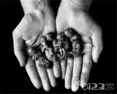 胎儿死了(胎儿死了) 第2张 胎儿死了(胎儿死了) 第2张