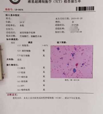 染色体异常如何检查,查胎儿染色体怎么查的 第2张 染色体异常如何检查,查胎儿染色体怎么查的 第2张