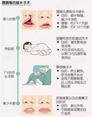 兔唇是怎样形成的，孕妈如何预防兔唇宝宝,兔唇的胎儿有哪些症状  第1张