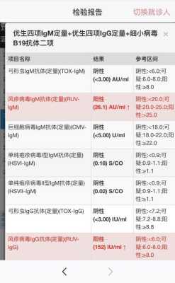 孕妇风疹病毒抗体igm阳性怎么回事?需要怎么办,孕期风疹病毒igg阳性对宝宝的影响 第2张 孕妇风疹病毒抗体igm阳性怎么回事?需要怎么办,孕期风疹病毒igg阳性对宝宝的影响 第2张