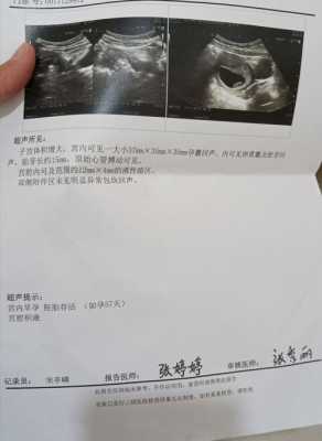 积液对胎儿有影响吗(怀孕宫颈积液对胎儿有影响吗) 第2张 积液对胎儿有影响吗(怀孕宫颈积液对胎儿有影响吗) 第2张