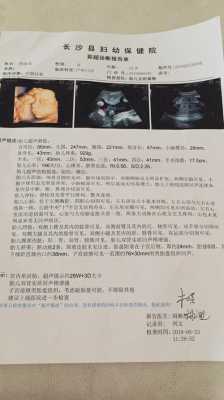 胎儿肾回声（胎儿肾回声）  第2张