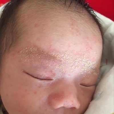 胎脂胎儿(宝宝出生为什么有胎脂) 第3张 胎脂胎儿(宝宝出生为什么有胎脂) 第3张