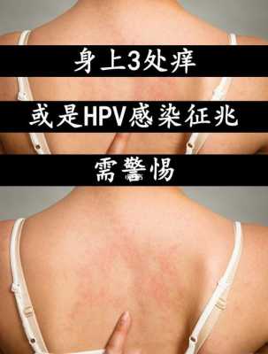 感染了HPV可以要孩子吗,孕期感染hpv怎么办,做什么检查能查出来  第3张