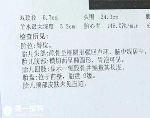 胎儿鼻骨正常值(如何看懂nt检查报告单) 第2张 胎儿鼻骨正常值(如何看懂nt检查报告单) 第2张