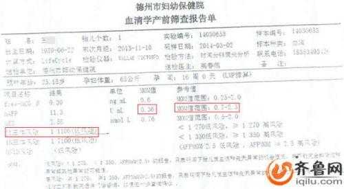 胎儿鼻骨正常值(如何看懂nt检查报告单) 第1张 胎儿鼻骨正常值(如何看懂nt检查报告单) 第1张