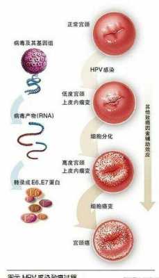 hpv对胎儿有影响吗(怀孕后感染hpv对胎儿有影响吗) 第1张 hpv对胎儿有影响吗(怀孕后感染hpv对胎儿有影响吗) 第1张